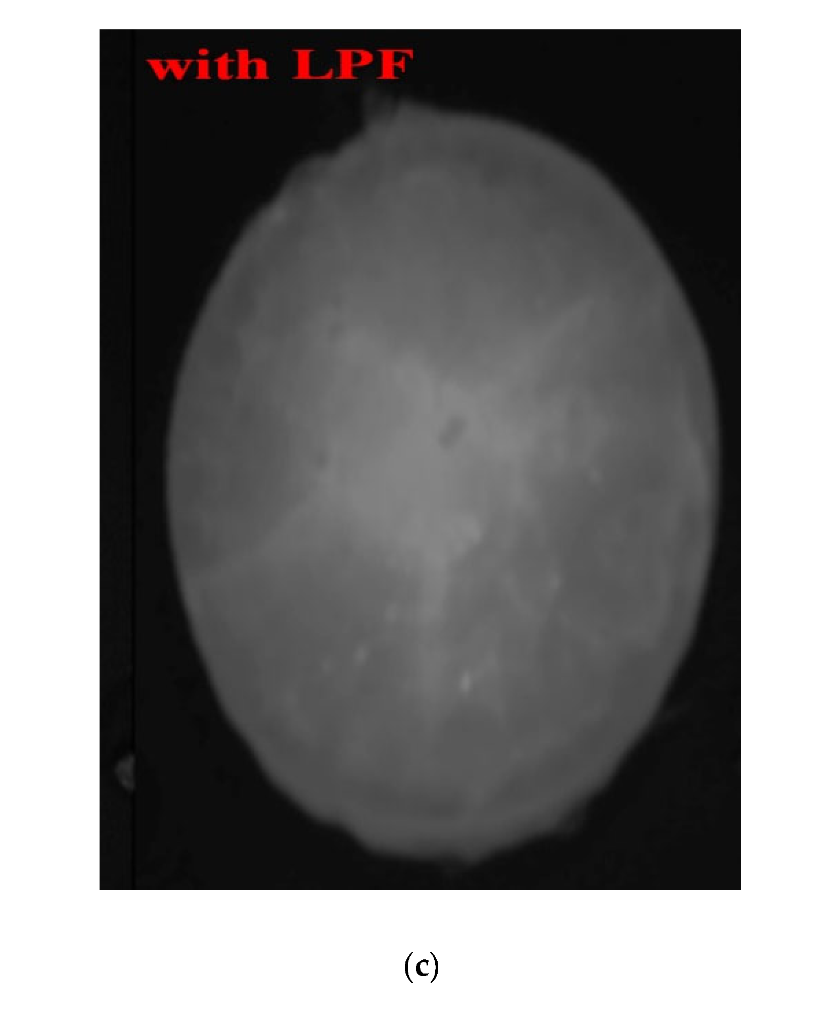 Diagnostics 12 01990 g018b