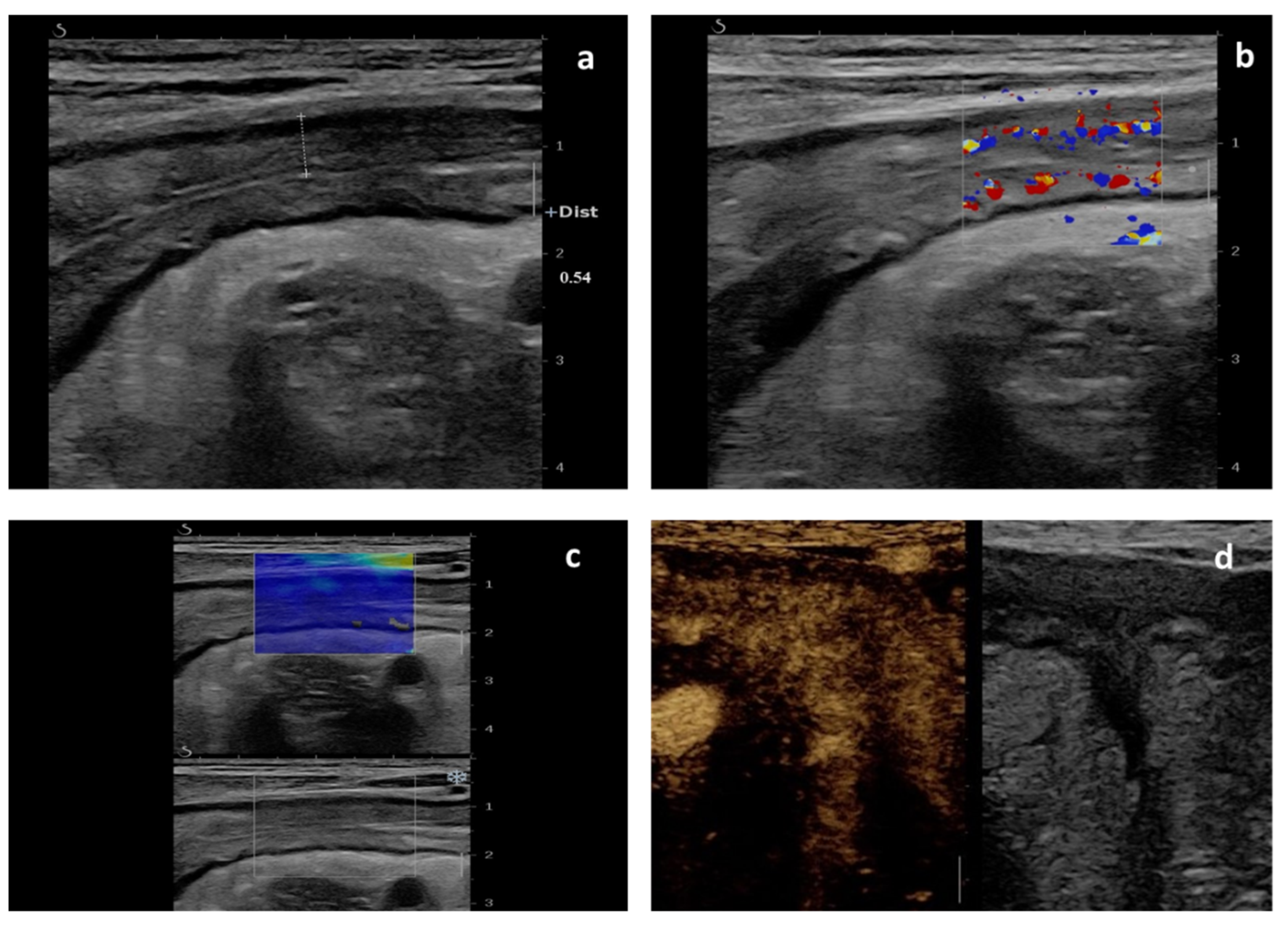 Diagnostics 12 01991 g001