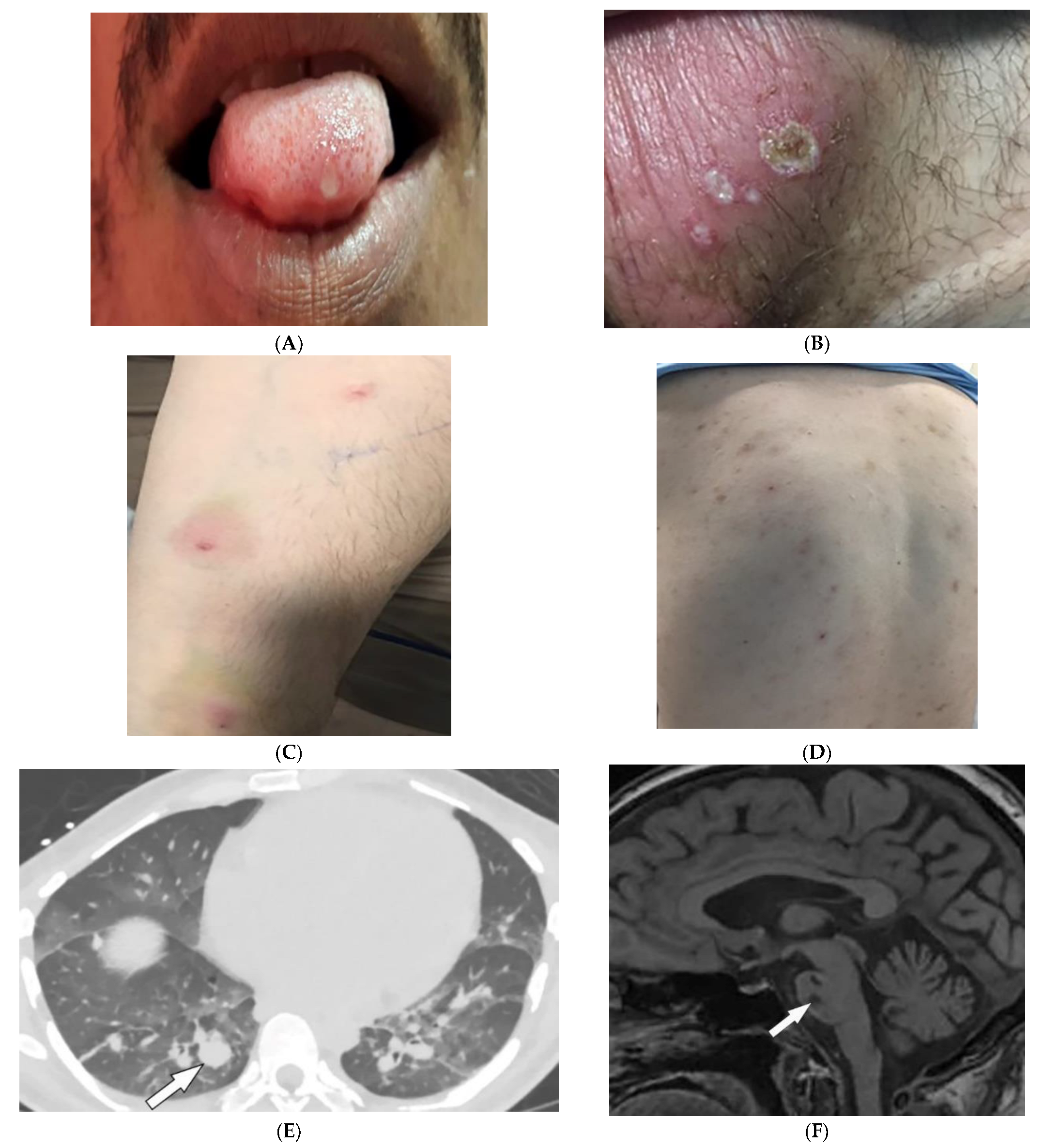 Diagnostics 12 02011 g007