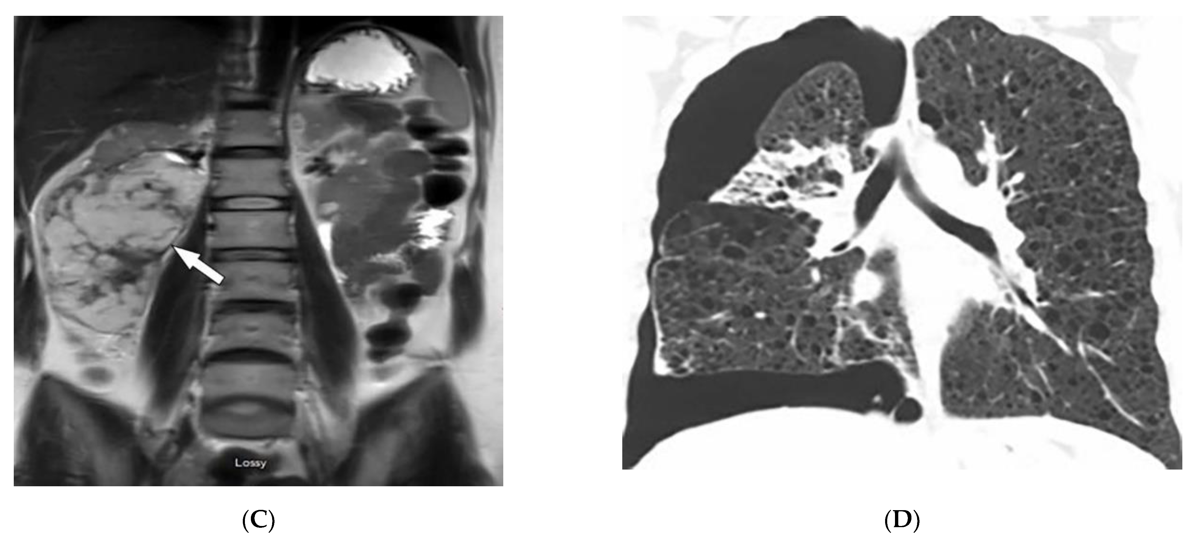 Diagnostics 12 02011 g008b