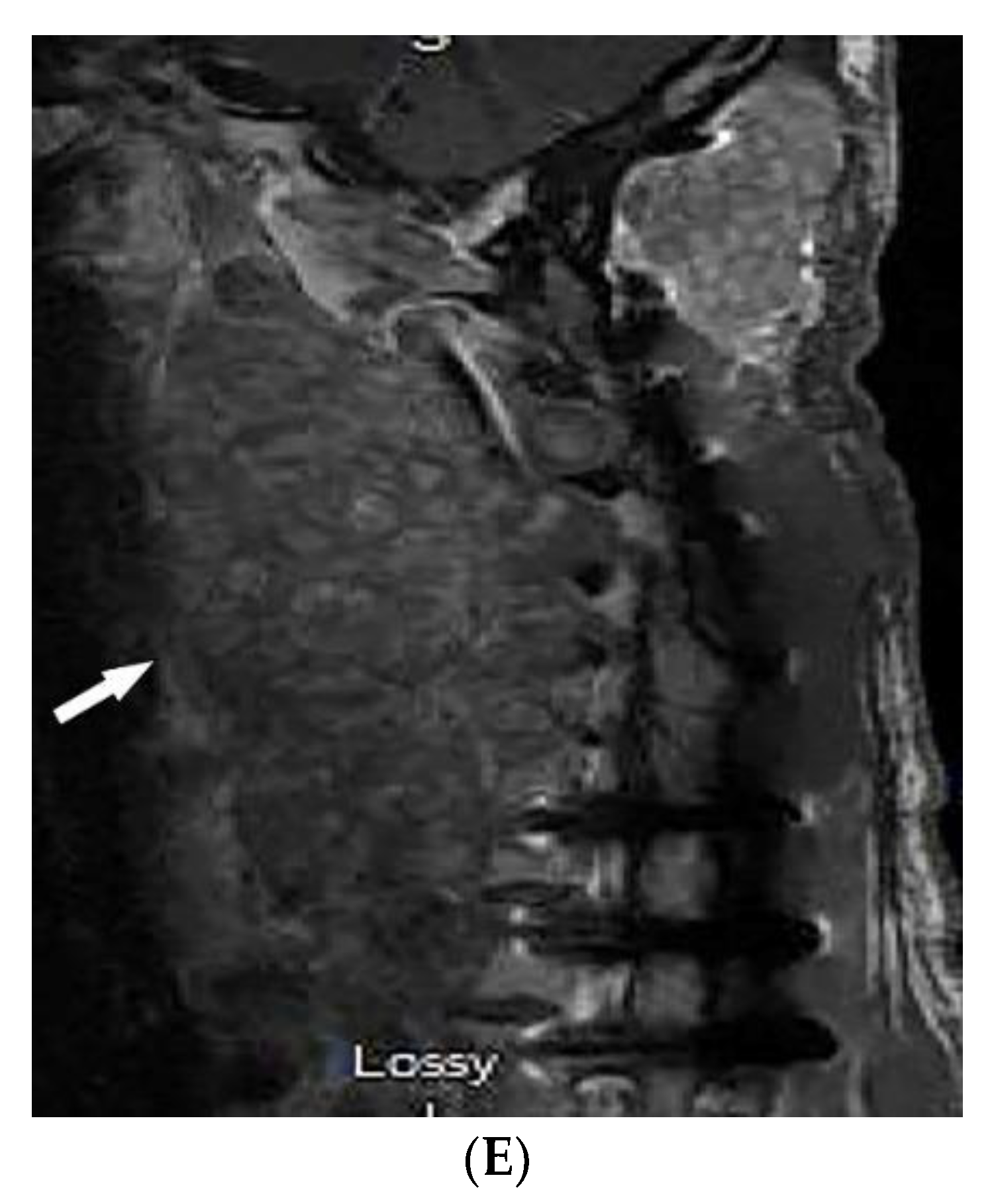 Diagnostics 12 02011 g009b