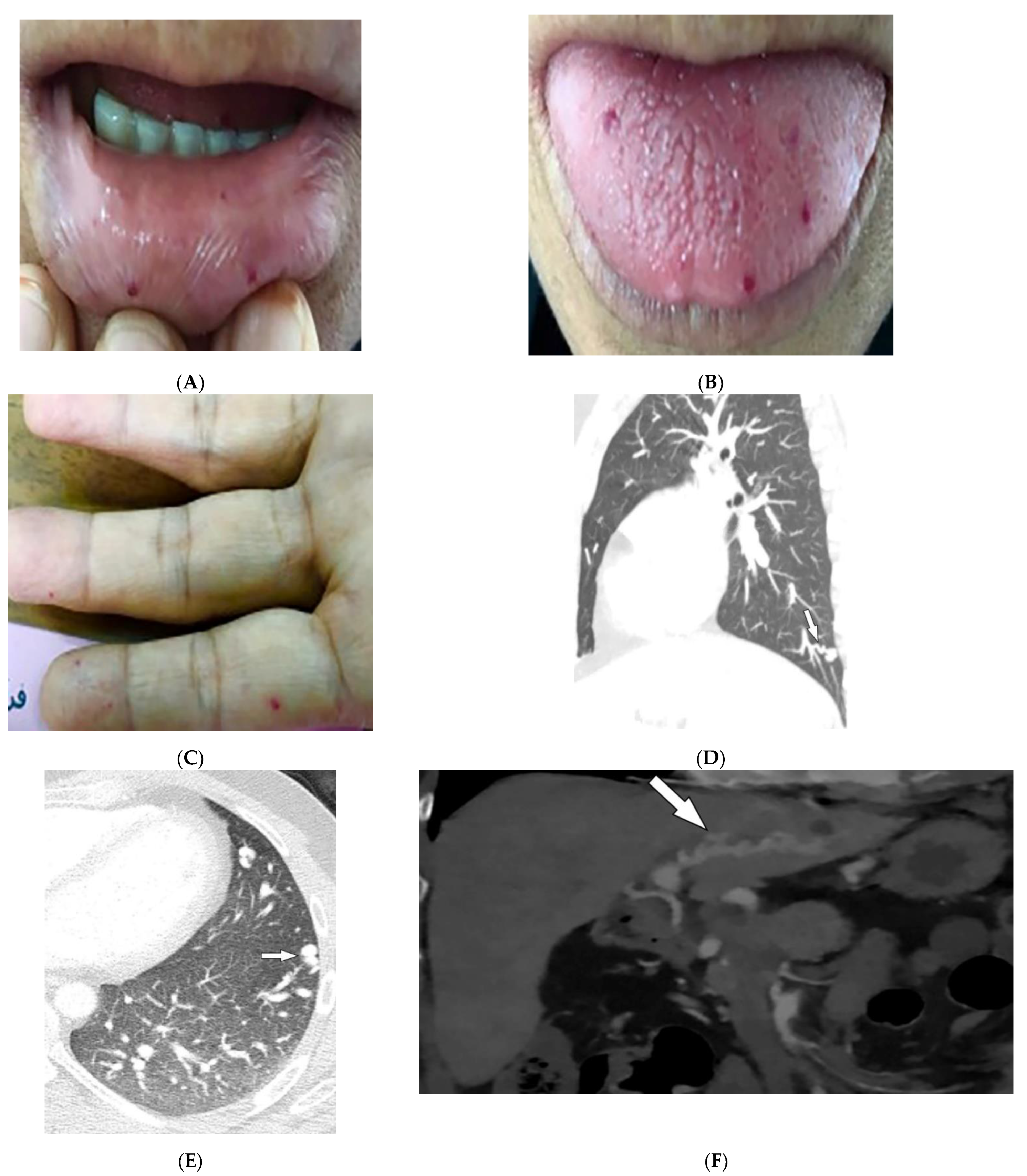 Diagnostics 12 02011 g013