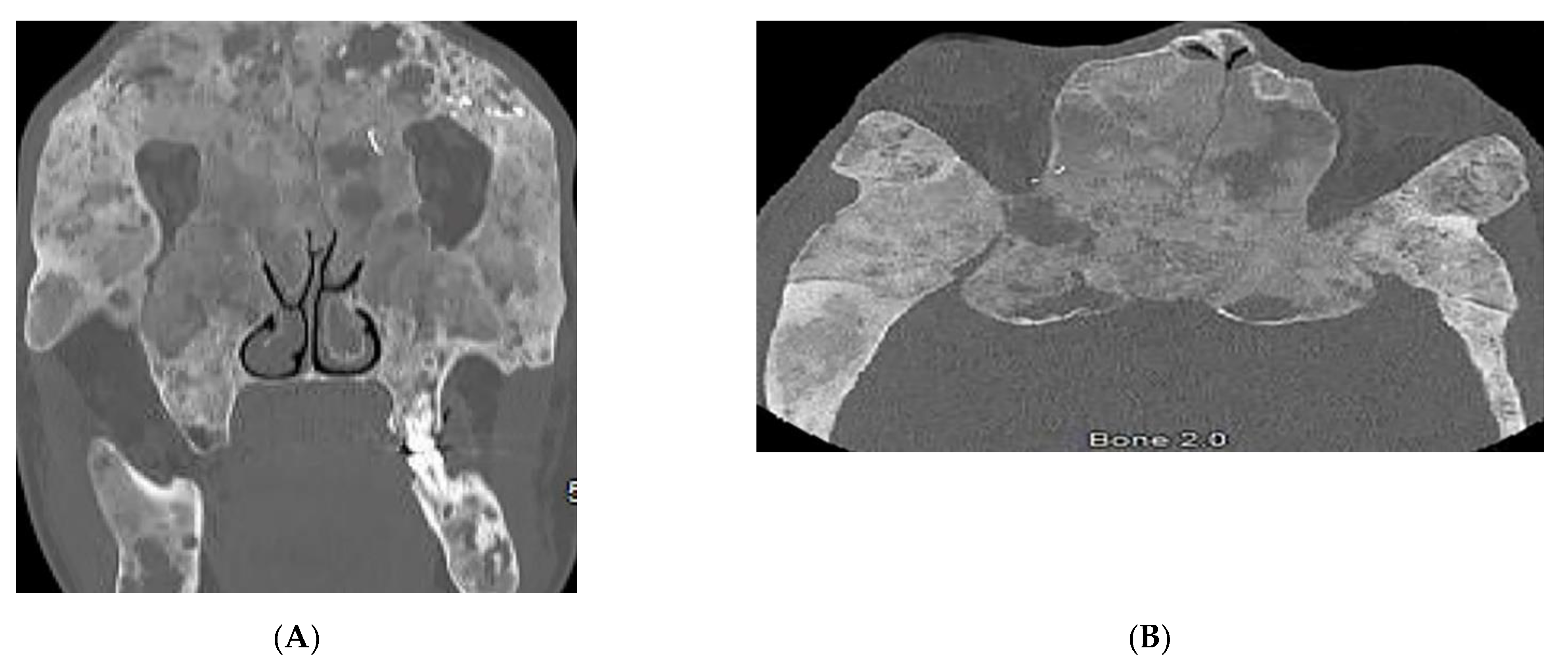 Diagnostics 12 02011 g015