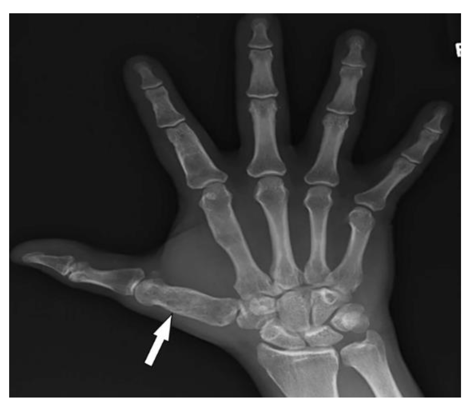 Diagnostics 12 02011 g017