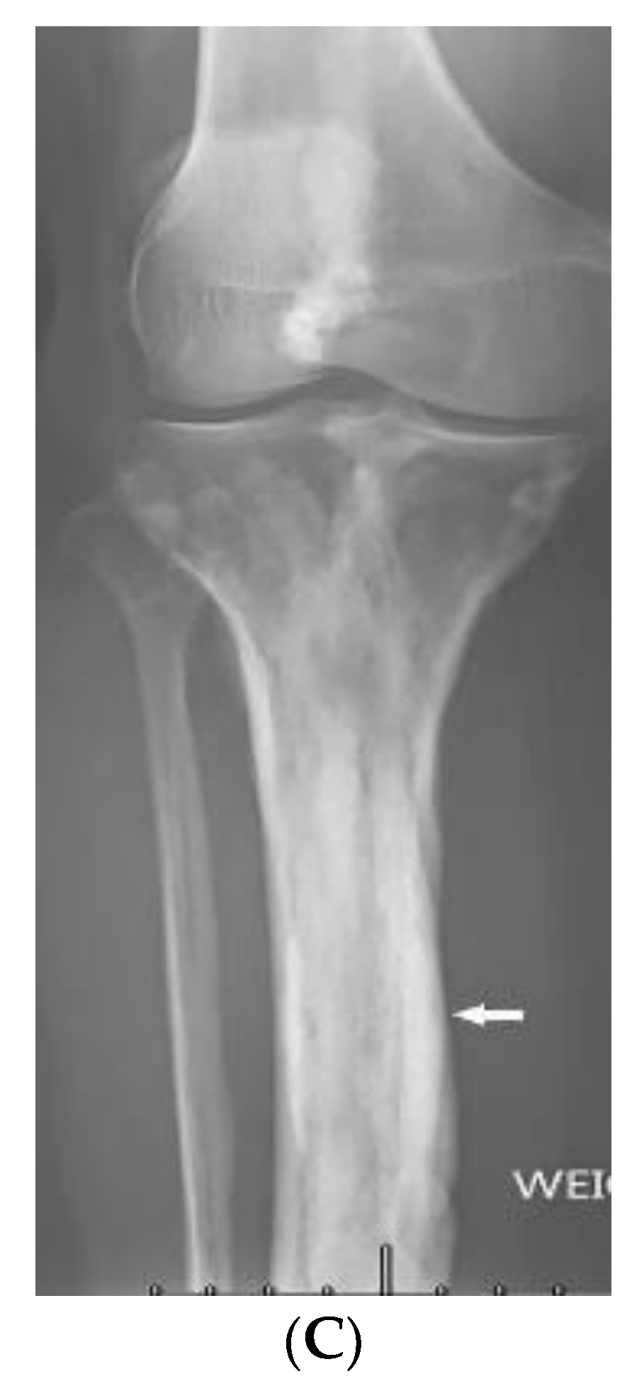 Diagnostics 12 02011 g018b