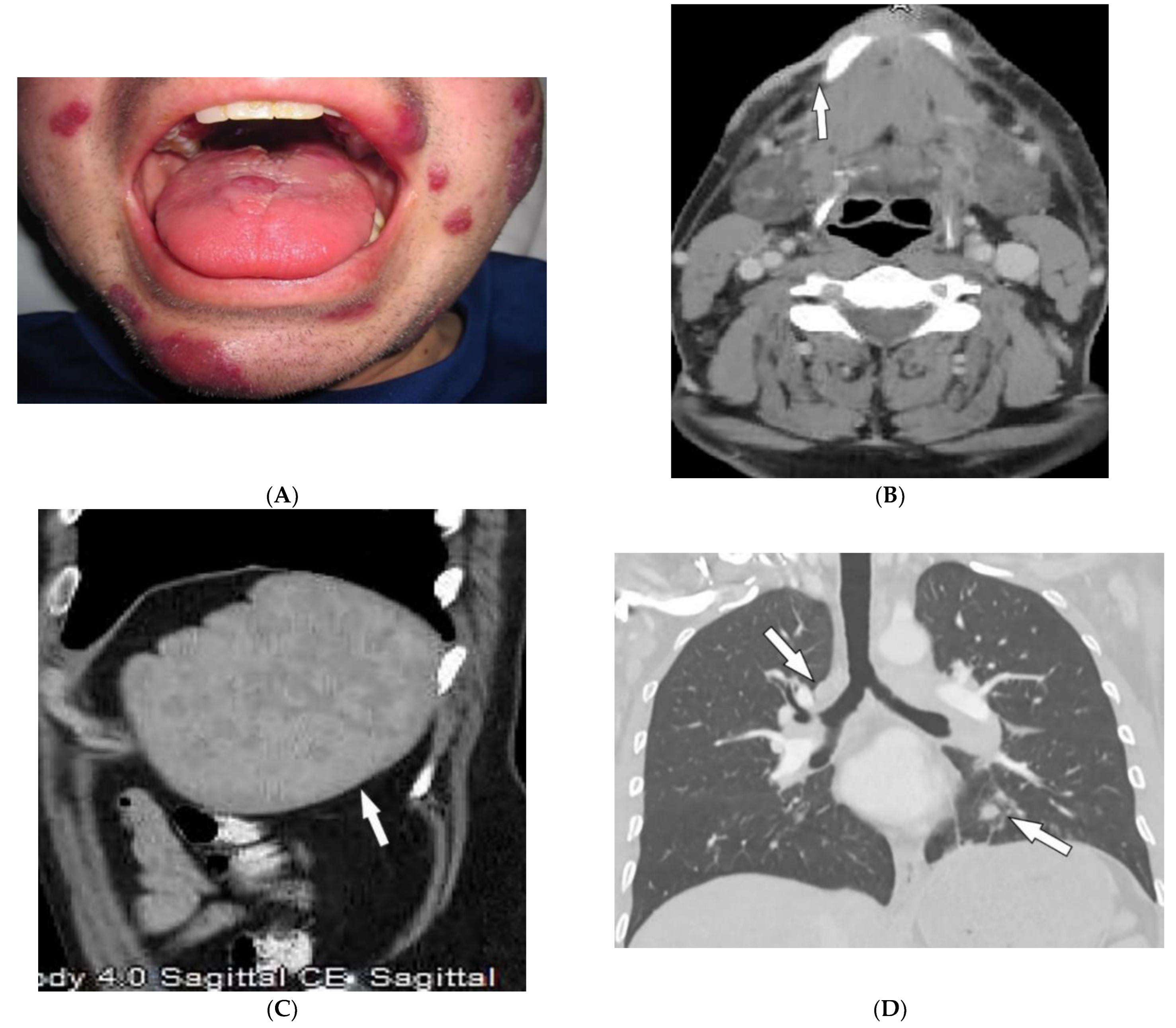 Diagnostics 12 02011 g021