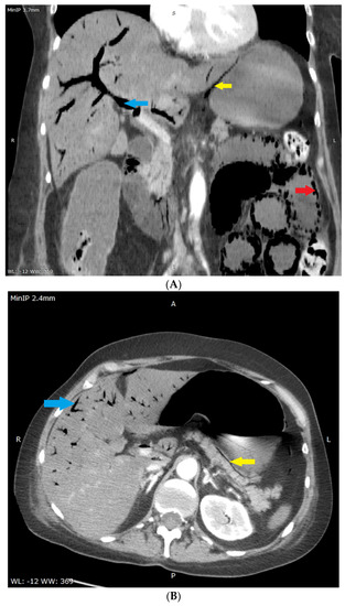 Diagnostics 12 02034 g002 550