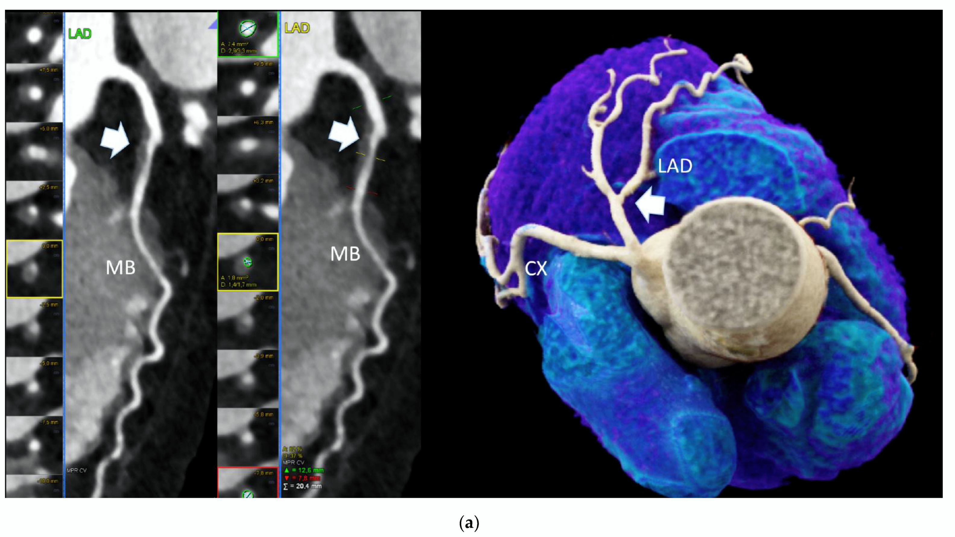 Diagnostics 12 02042 g001a