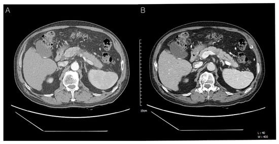 Diagnostics 12 02046 g001
