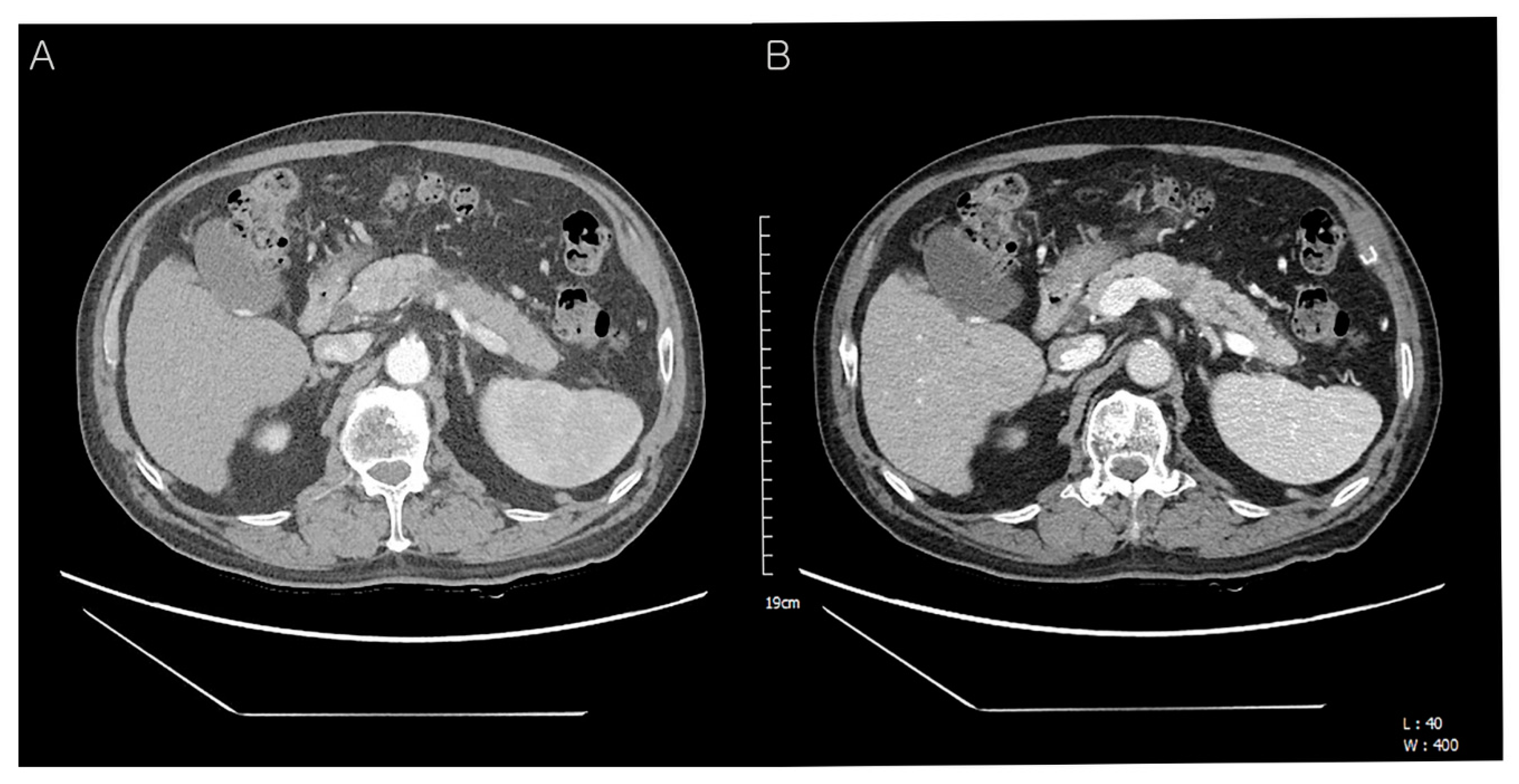 Diagnostics 12 02046 g001 Diagnostics 12 02046 g001