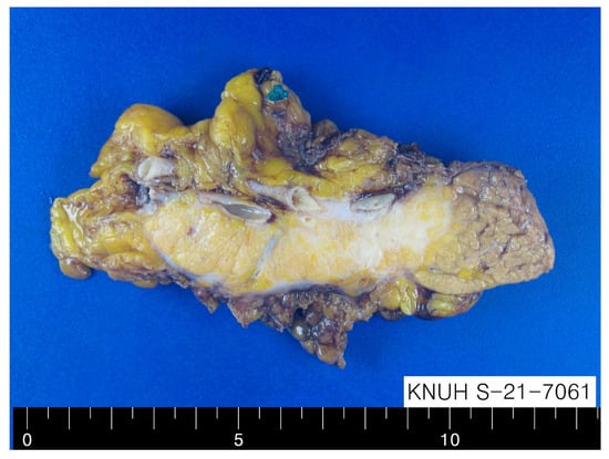 Diagnostics 12 02046 g002