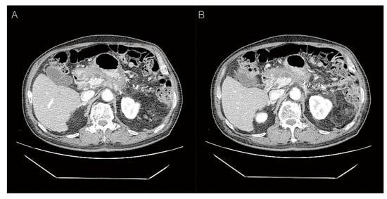Diagnostics 12 02046 g004