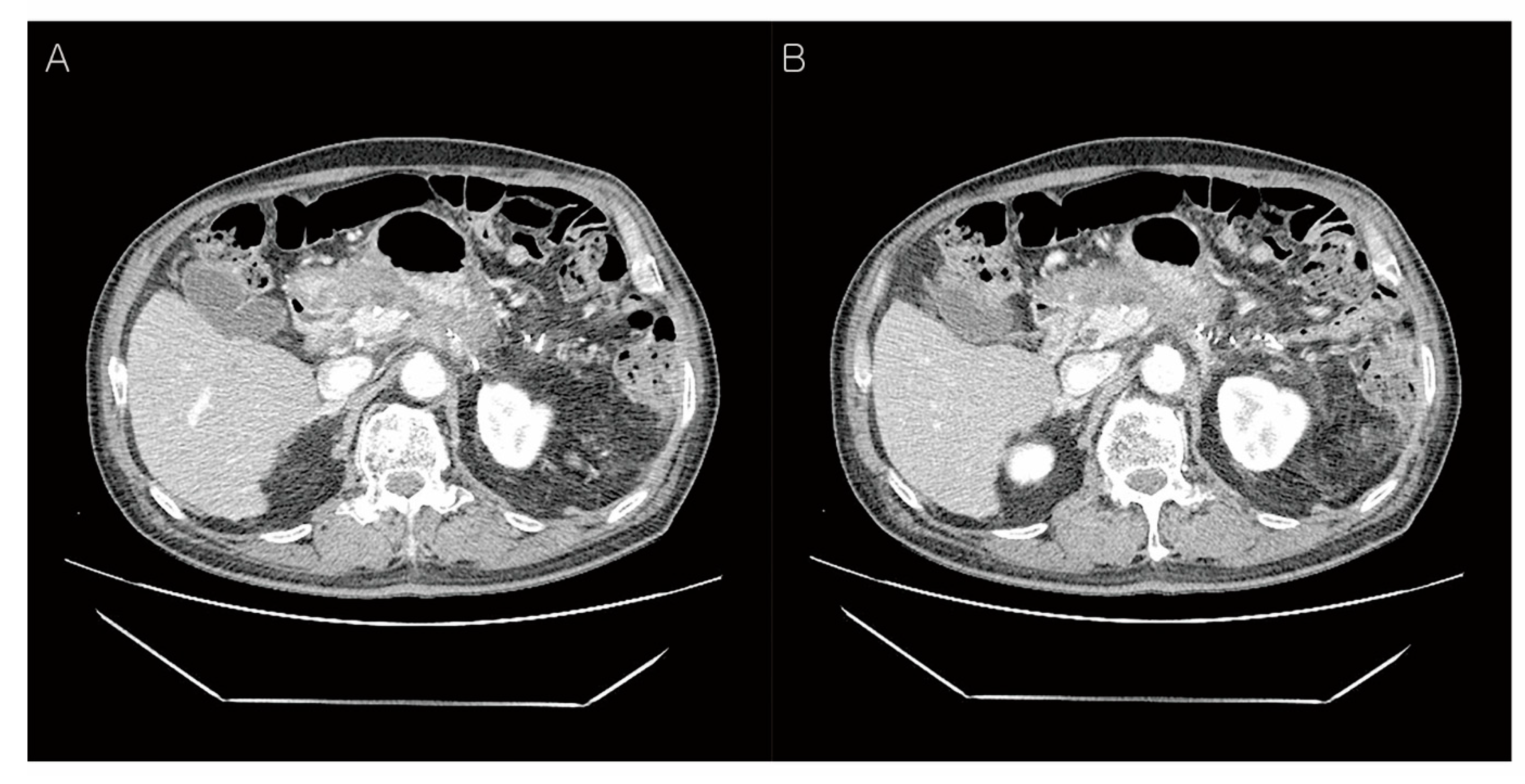 Diagnostics 12 02046 g004 Diagnostics 12 02046 g004