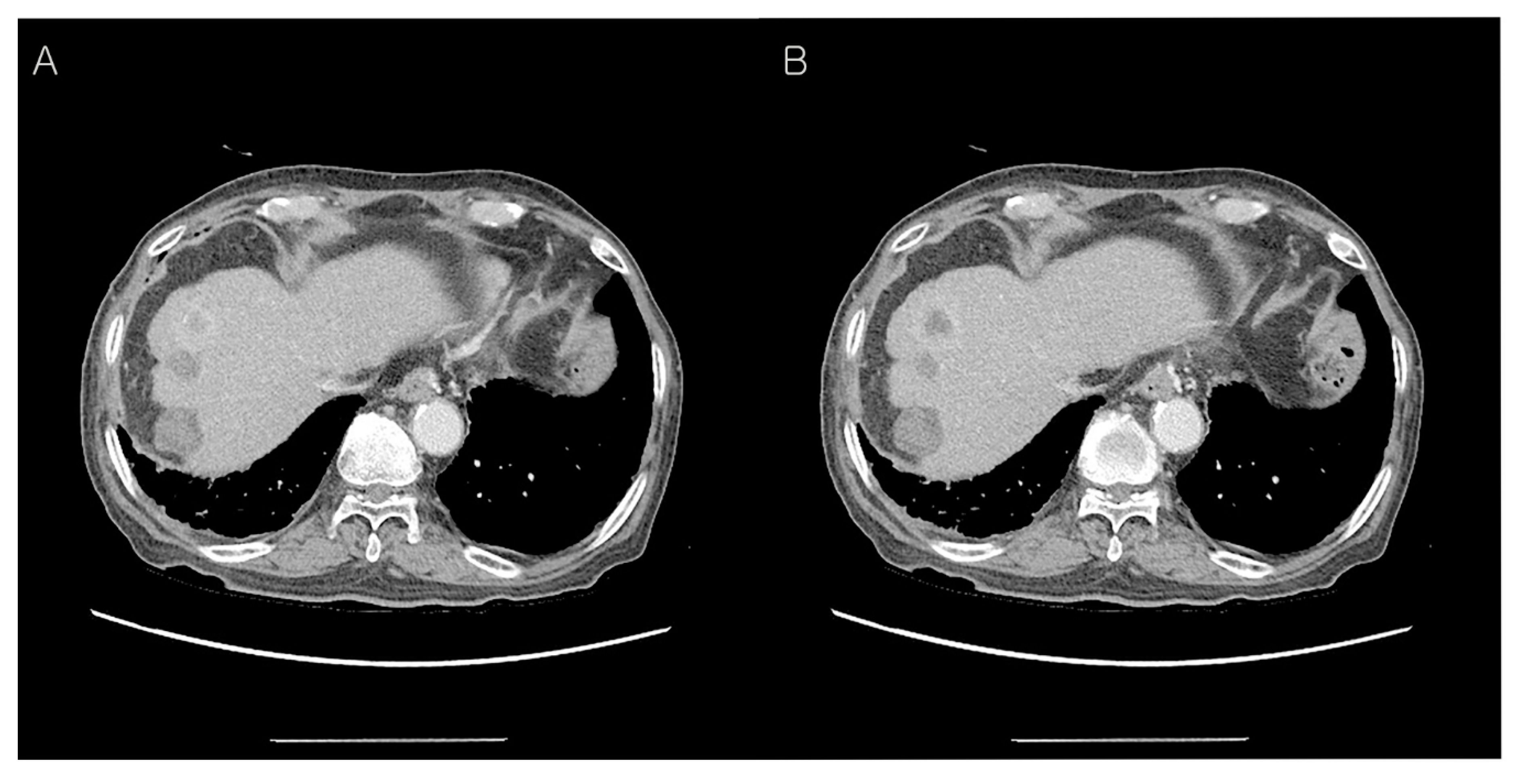Diagnostics 12 02046 g005 Diagnostics 12 02046 g005