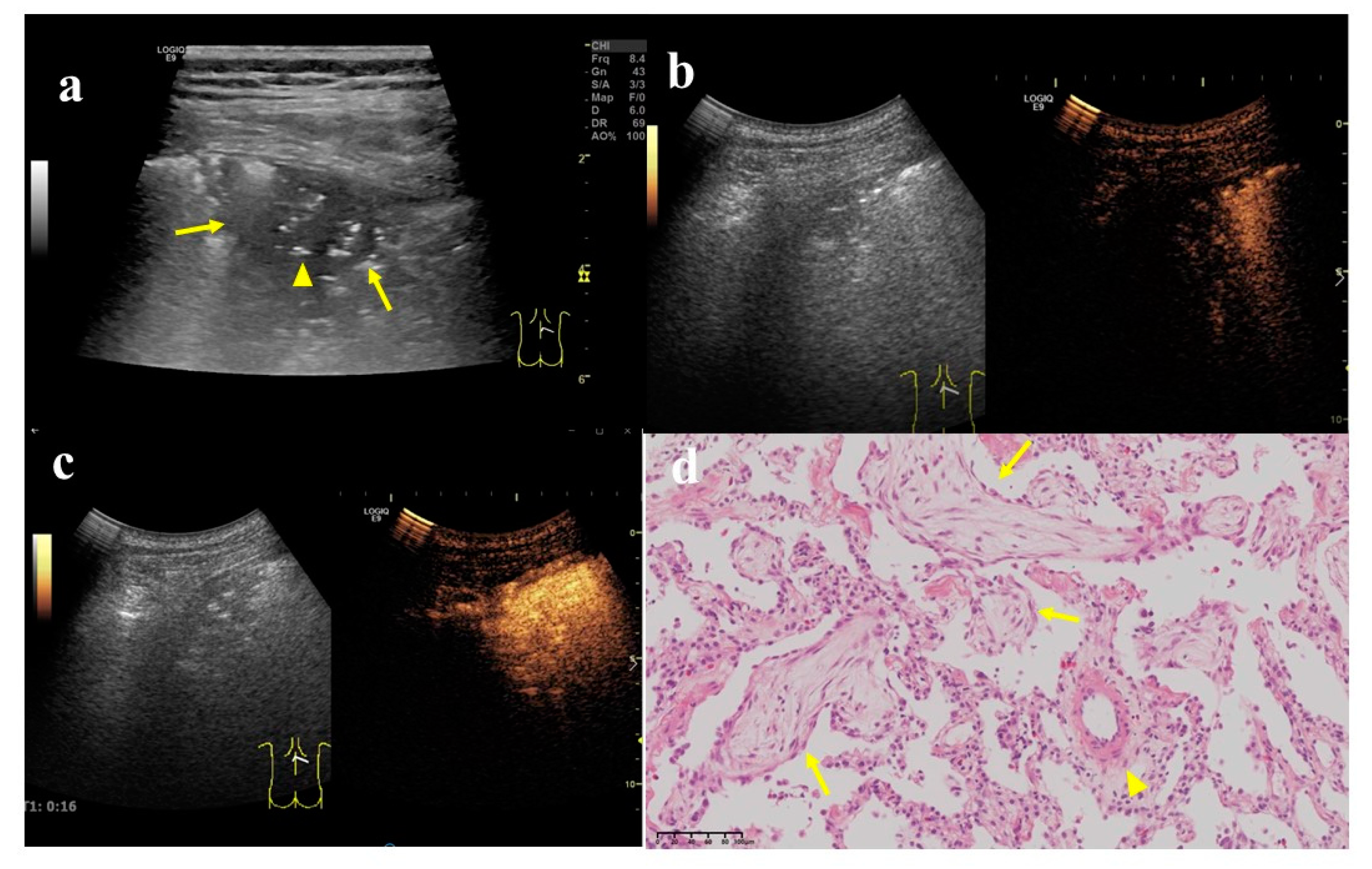 Diagnostics 12 02074 g004 Diagnostics 12 02074 g004