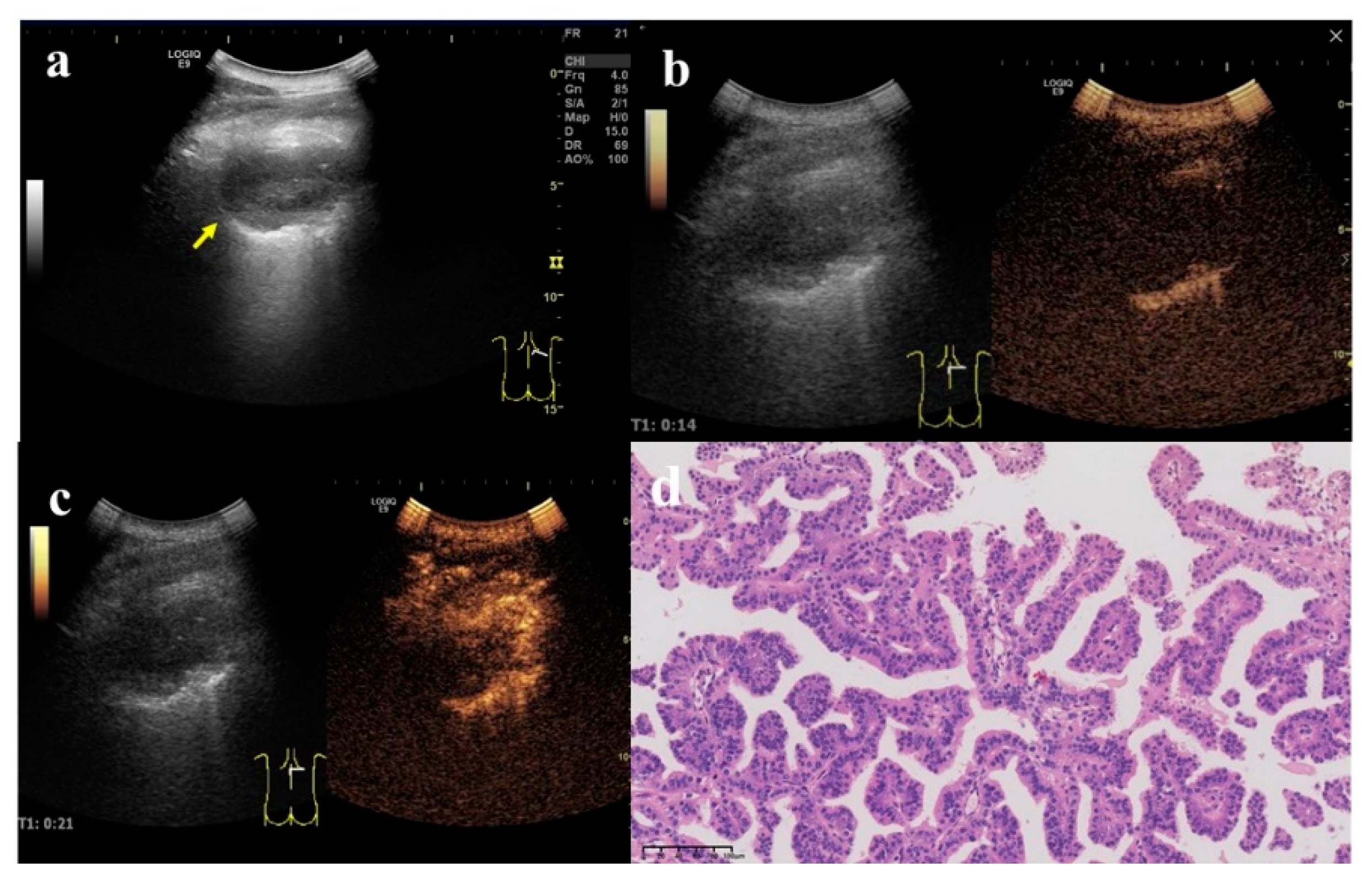 Diagnostics 12 02074 g005 Diagnostics 12 02074 g005