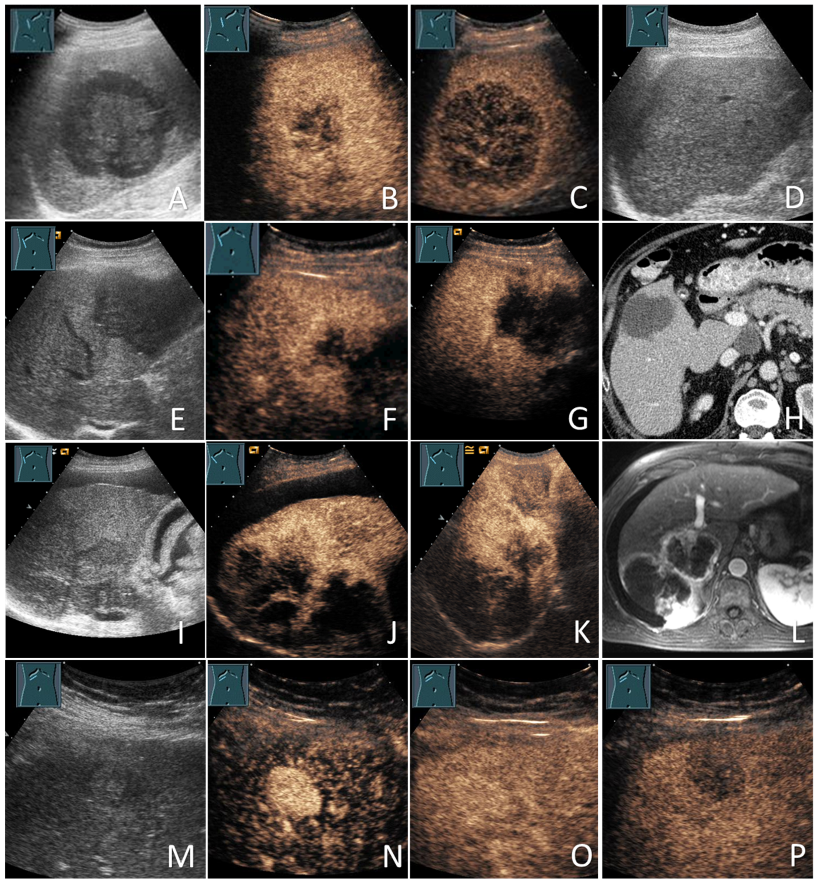 Diagnostics 12 02079 g003