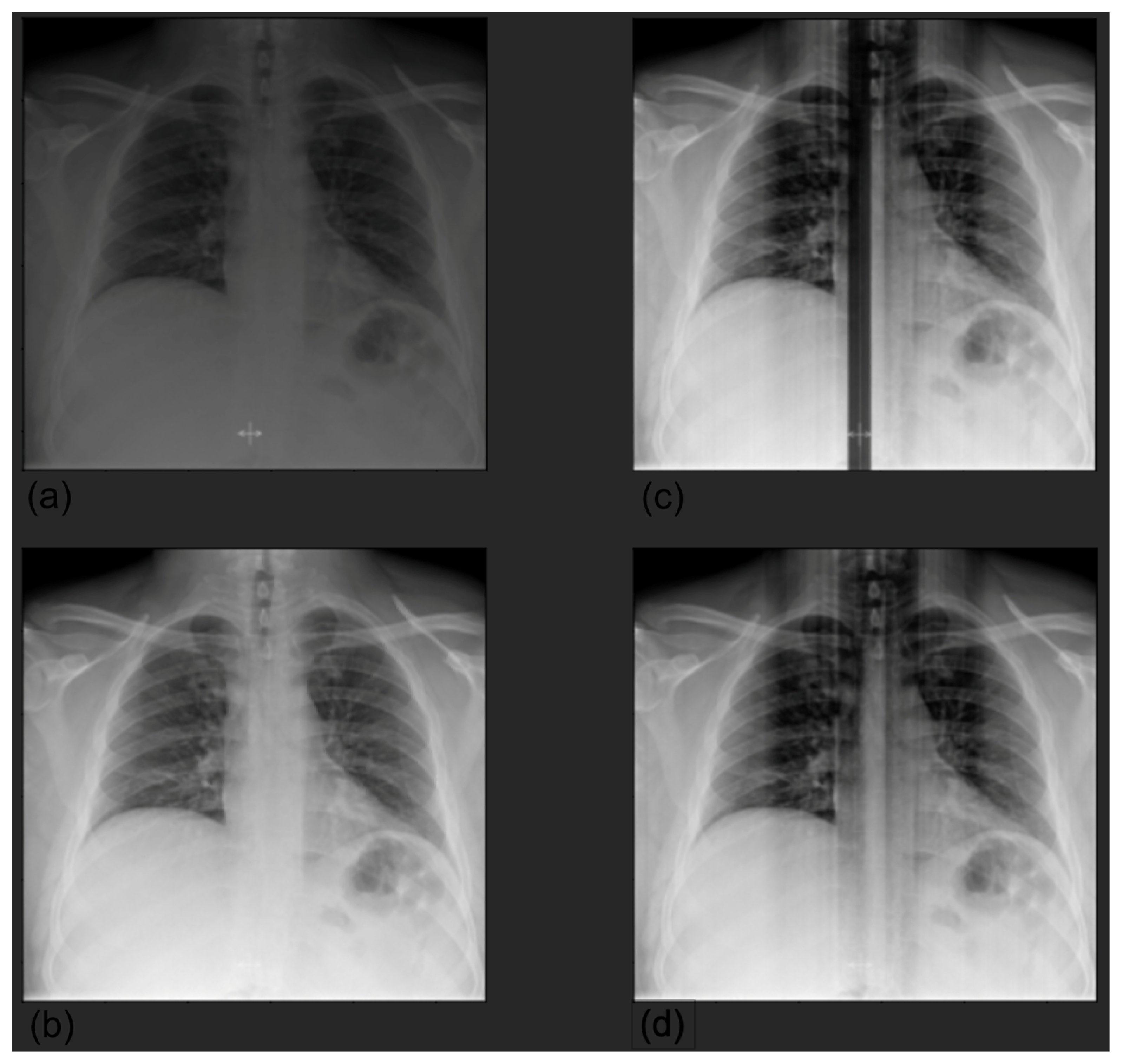 Diagnostics 12 02084 g001