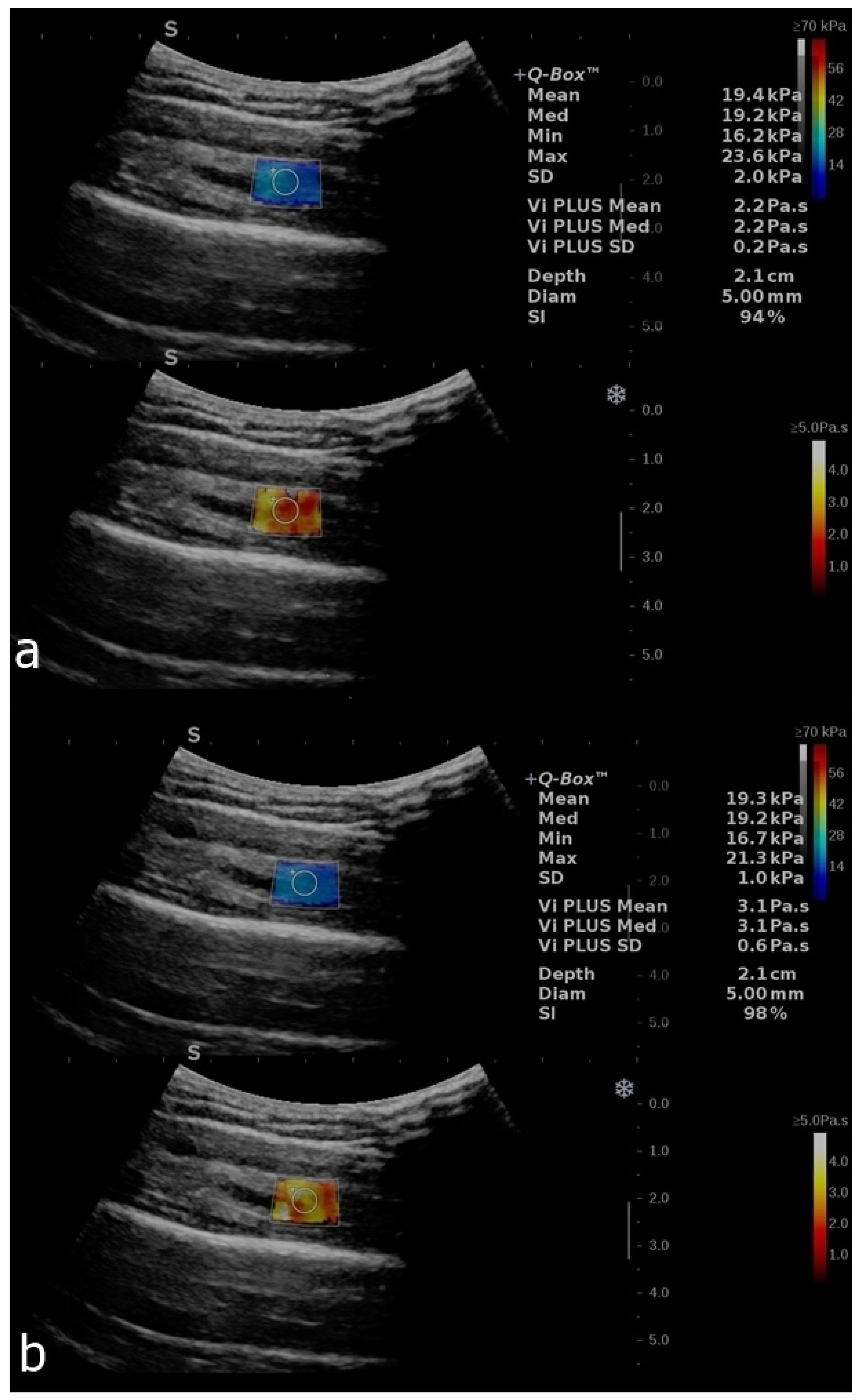 Diagnostics 12 02138 g003 Diagnostics 12 02138 g003