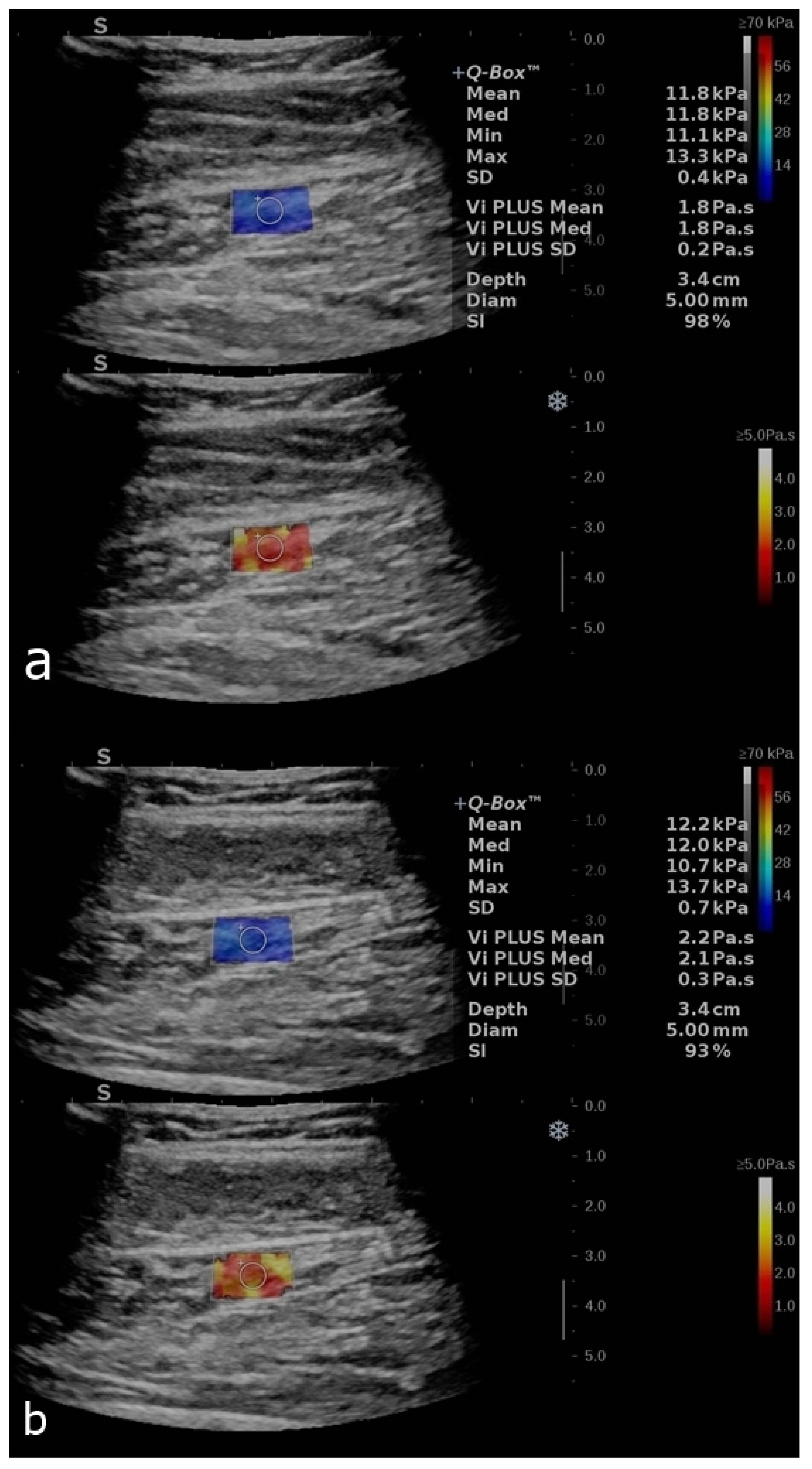 Diagnostics 12 02138 g004 Diagnostics 12 02138 g004