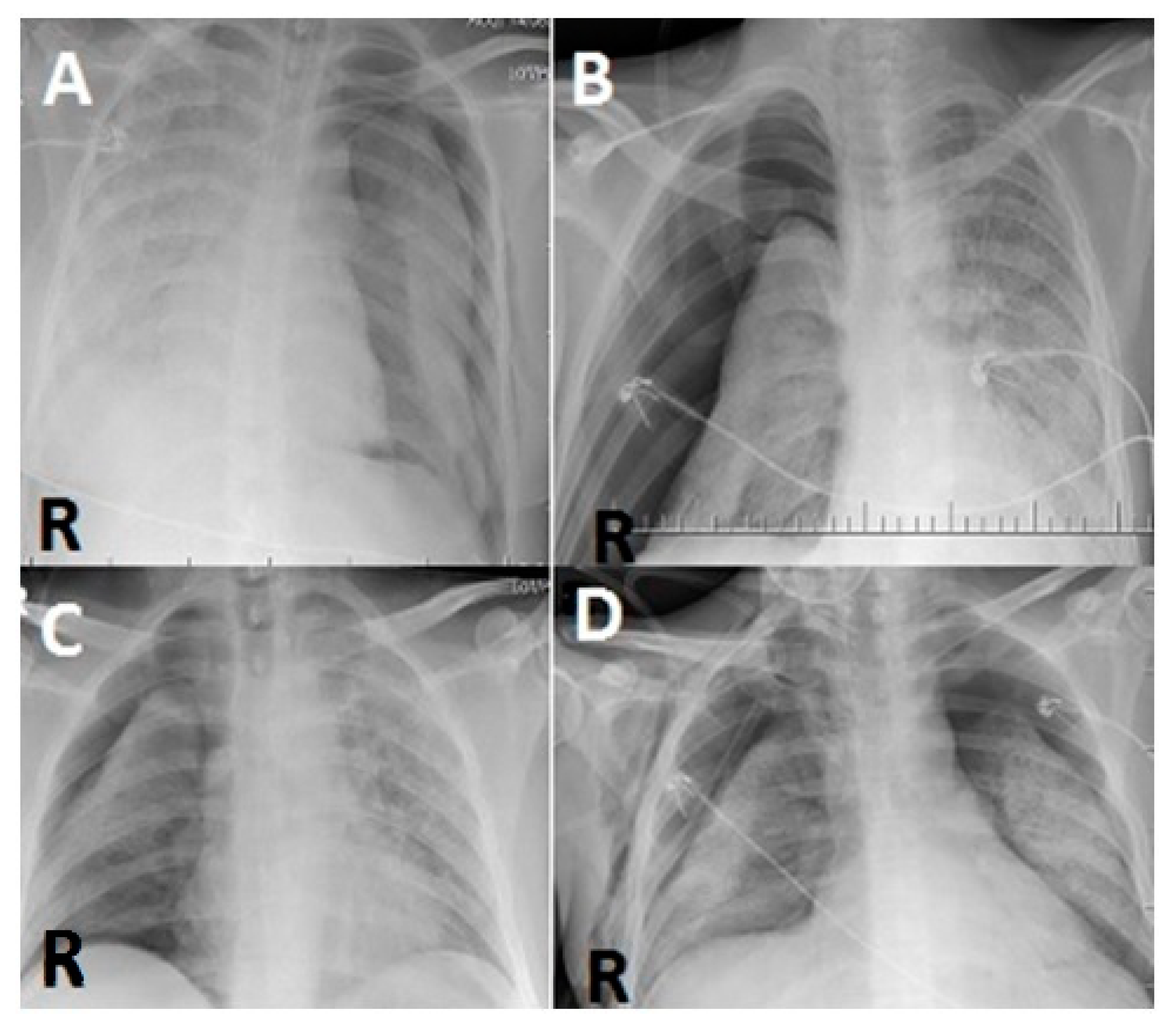 Diagnostics 12 02140 g002 Diagnostics 12 02140 g002