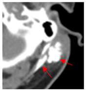 Diagnostics 12 02156 i002