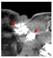 Diagnostics 12 02156 i006