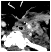 Diagnostics 12 02156 i007