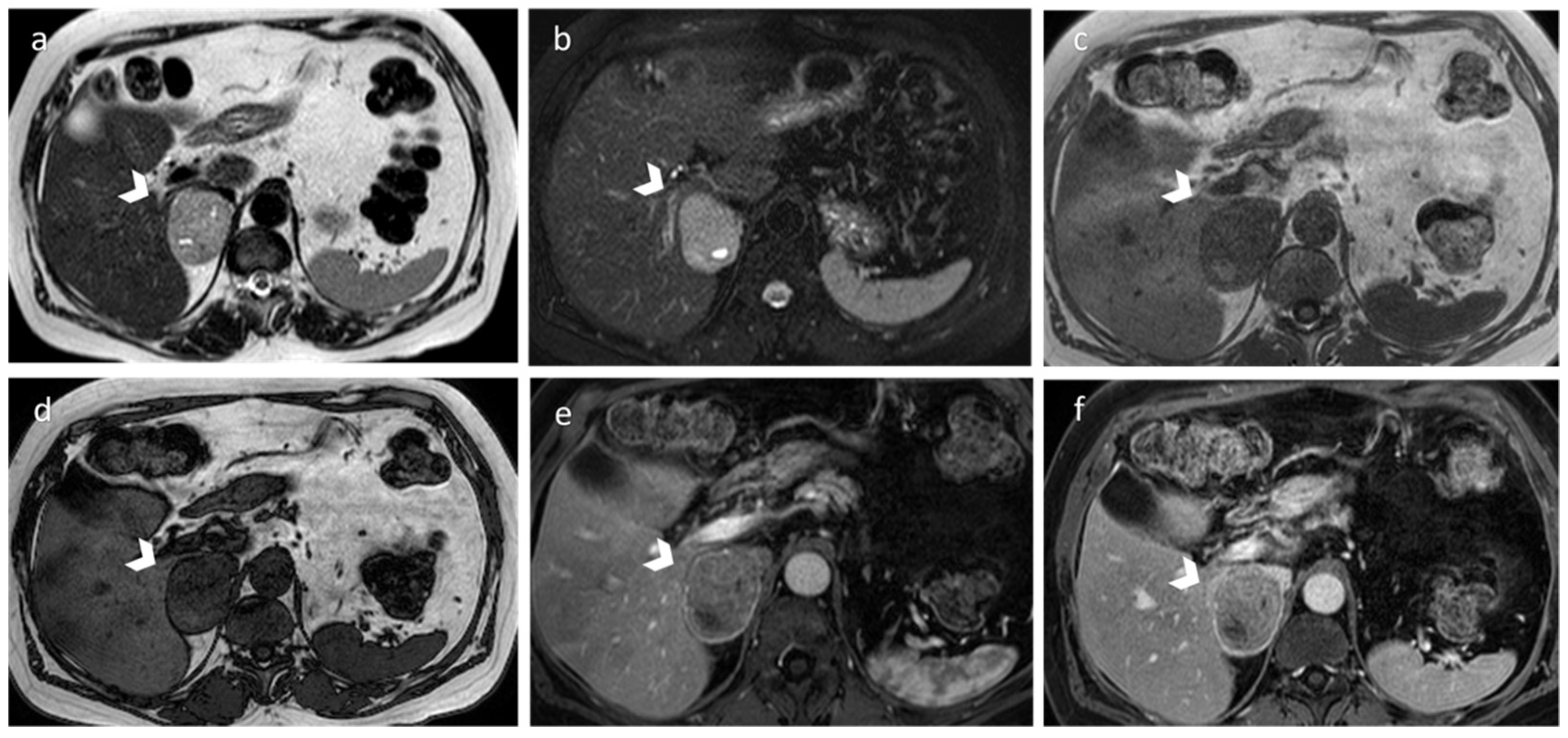 Diagnostics 12 02171 g006