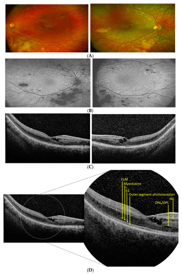 Diagnostics 12 02183 g001