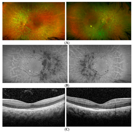 Diagnostics 12 02183 g002