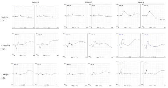 Diagnostics 12 02183 g003