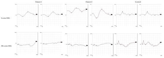 Diagnostics 12 02183 g004