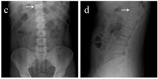Diagnostics 12 02190 g001b