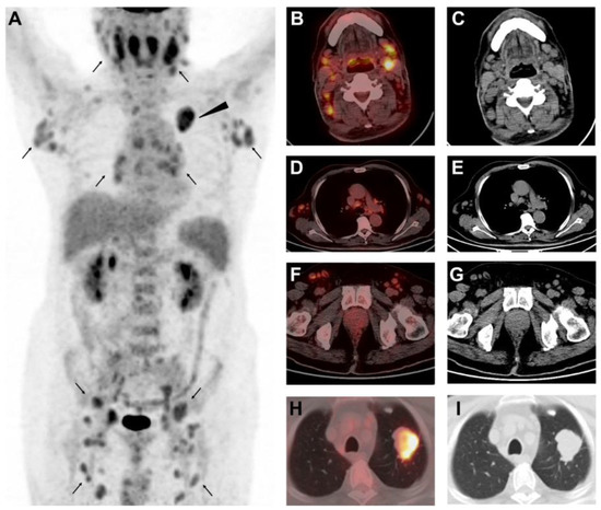 Diagnostics 12 02211 g001 550