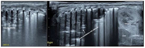 Diagnostics 12 02253 g001 550