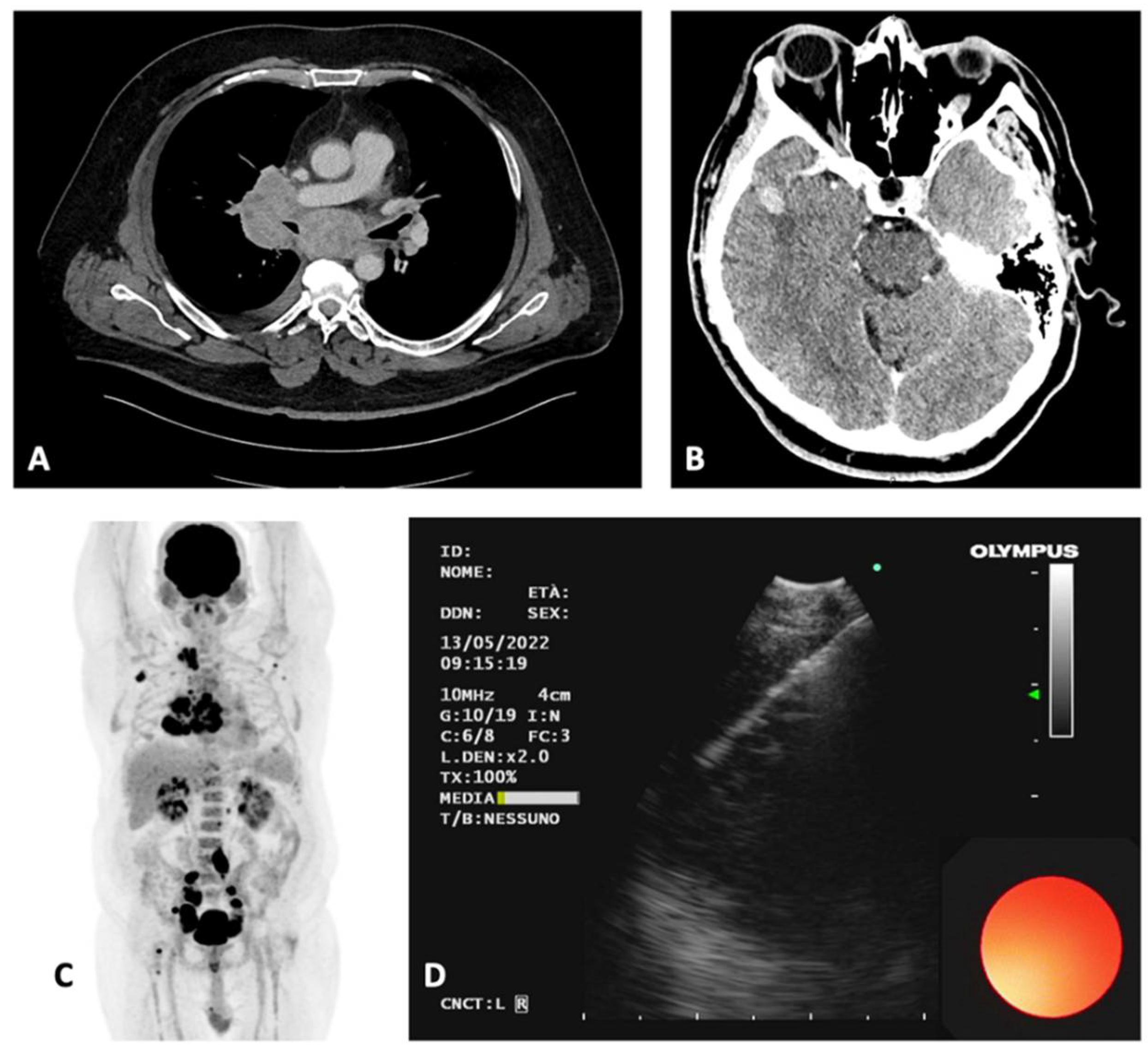Diagnostics 12 02254 g001