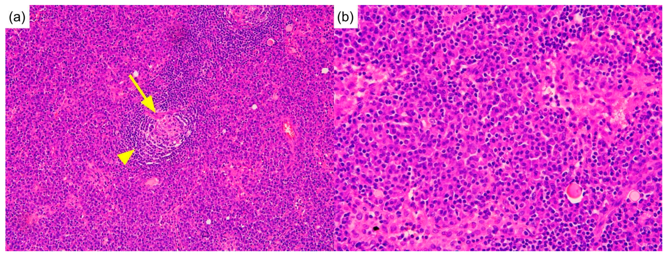 Diagnostics 12 02261 g002 Diagnostics 12 02261 g002