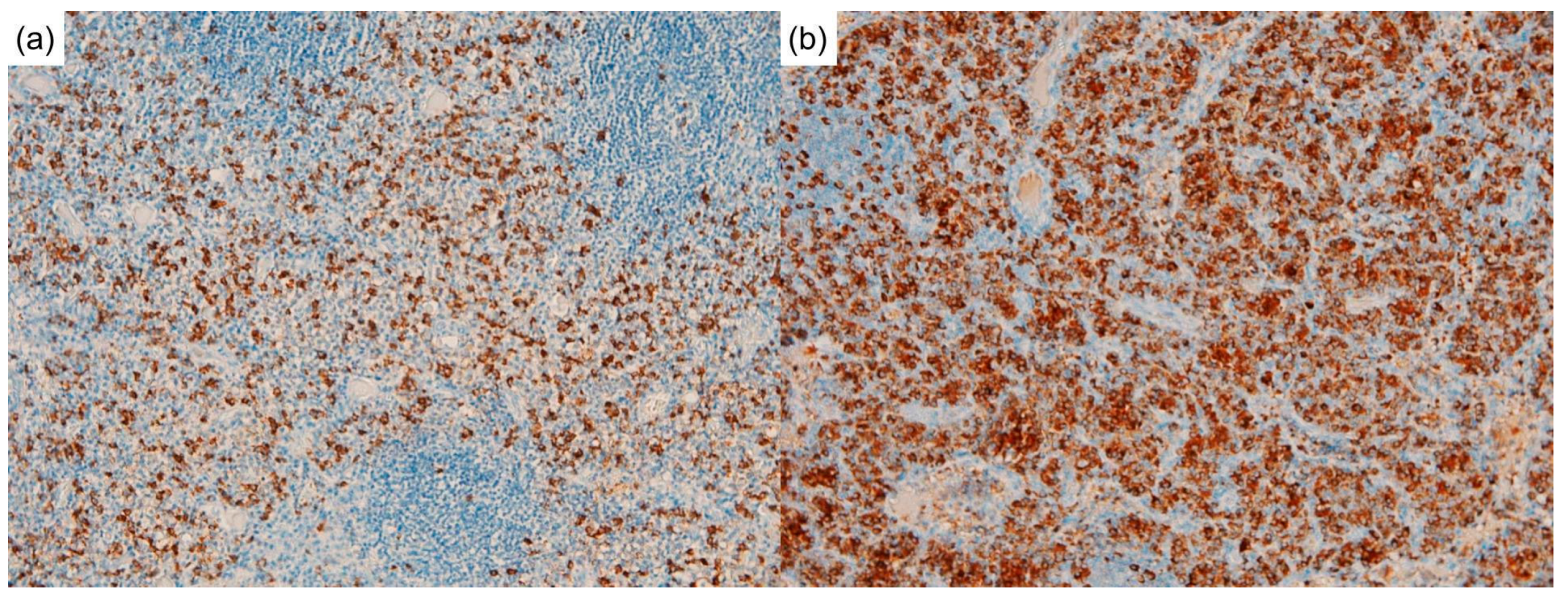 Diagnostics 12 02261 g004 Diagnostics 12 02261 g004