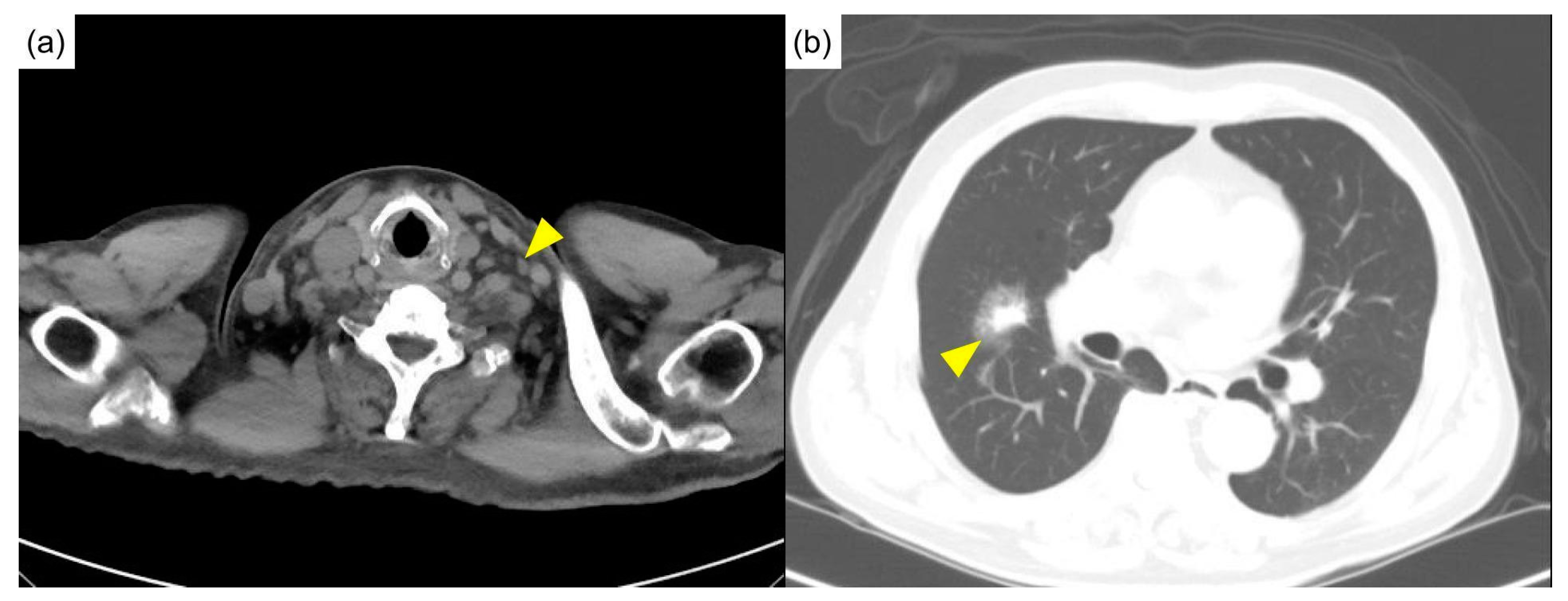 Diagnostics 12 02261 g005 Diagnostics 12 02261 g005