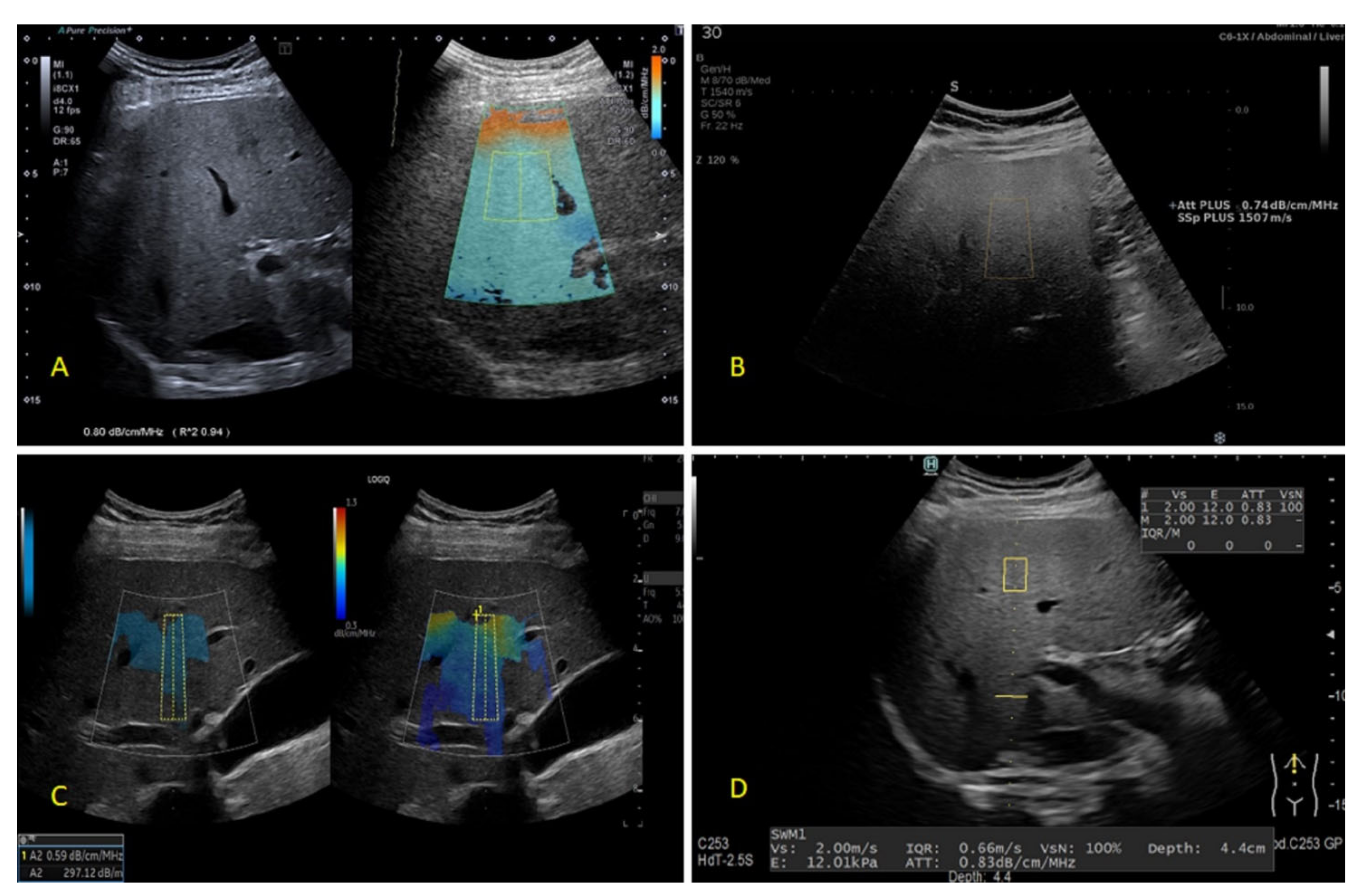Diagnostics 12 02287 g001 Diagnostics 12 02287 g001