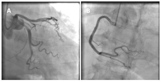 Diagnostics 12 02304 g001a 550