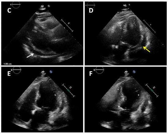 Diagnostics 12 02304 g001b 550