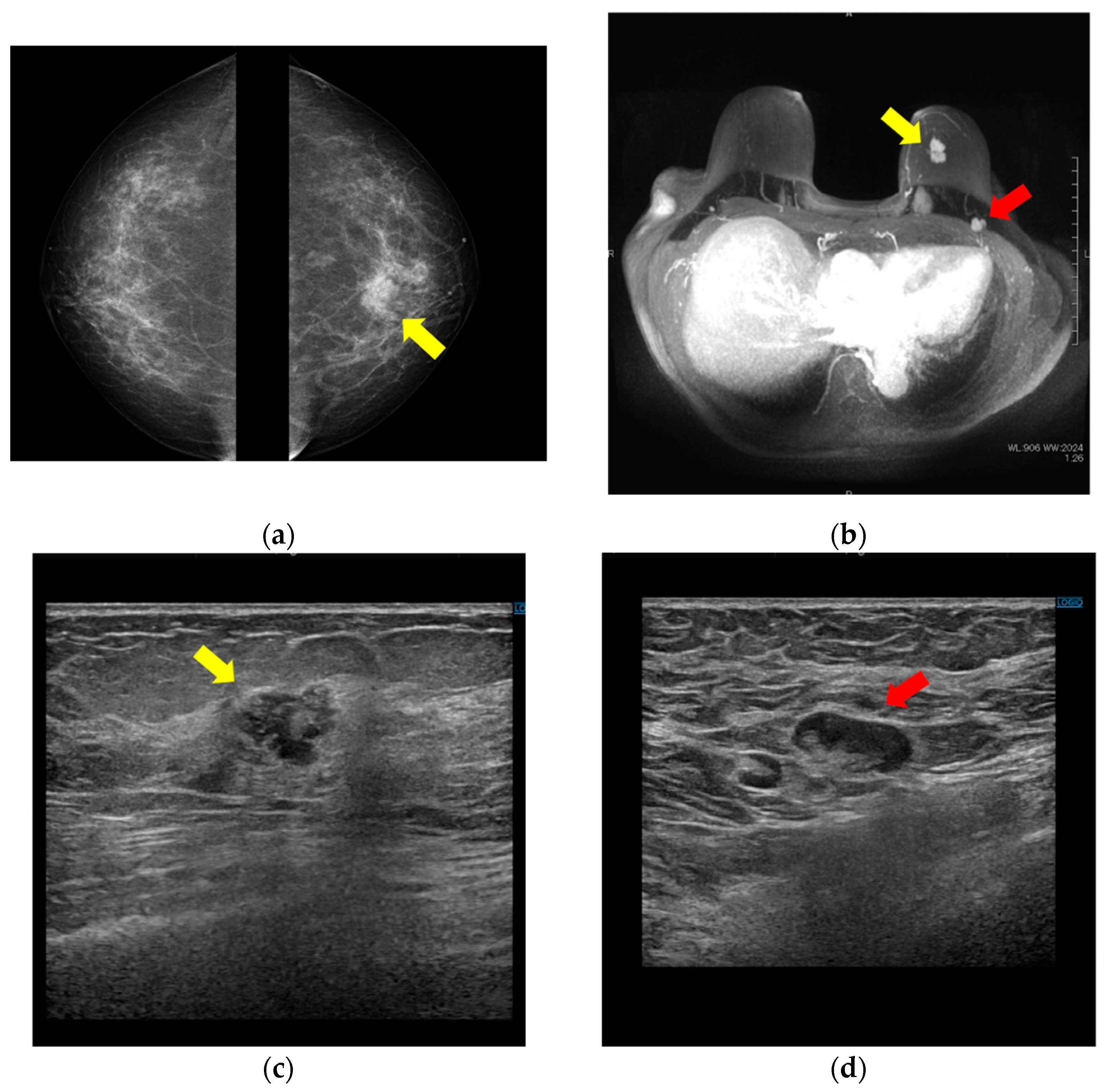 Diagnostics 12 02308 g001 Diagnostics 12 02308 g001