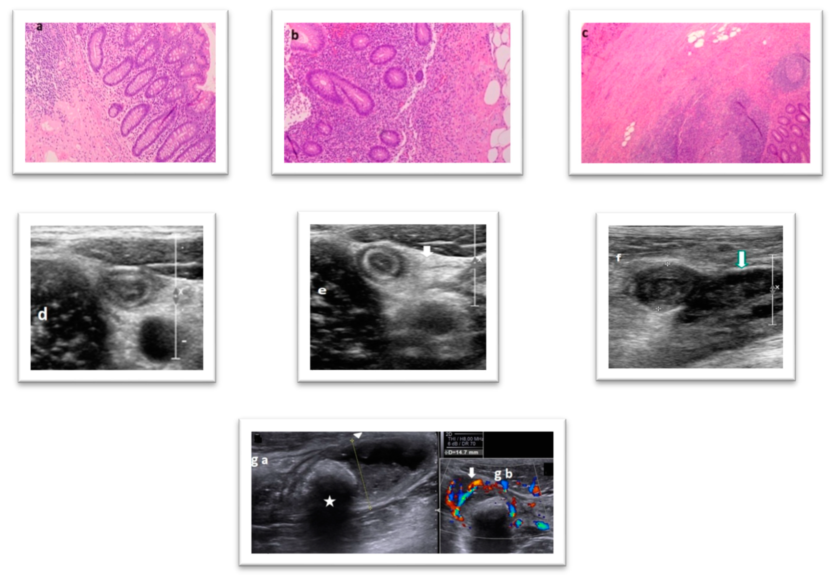 Diagnostics 12 02315 g001