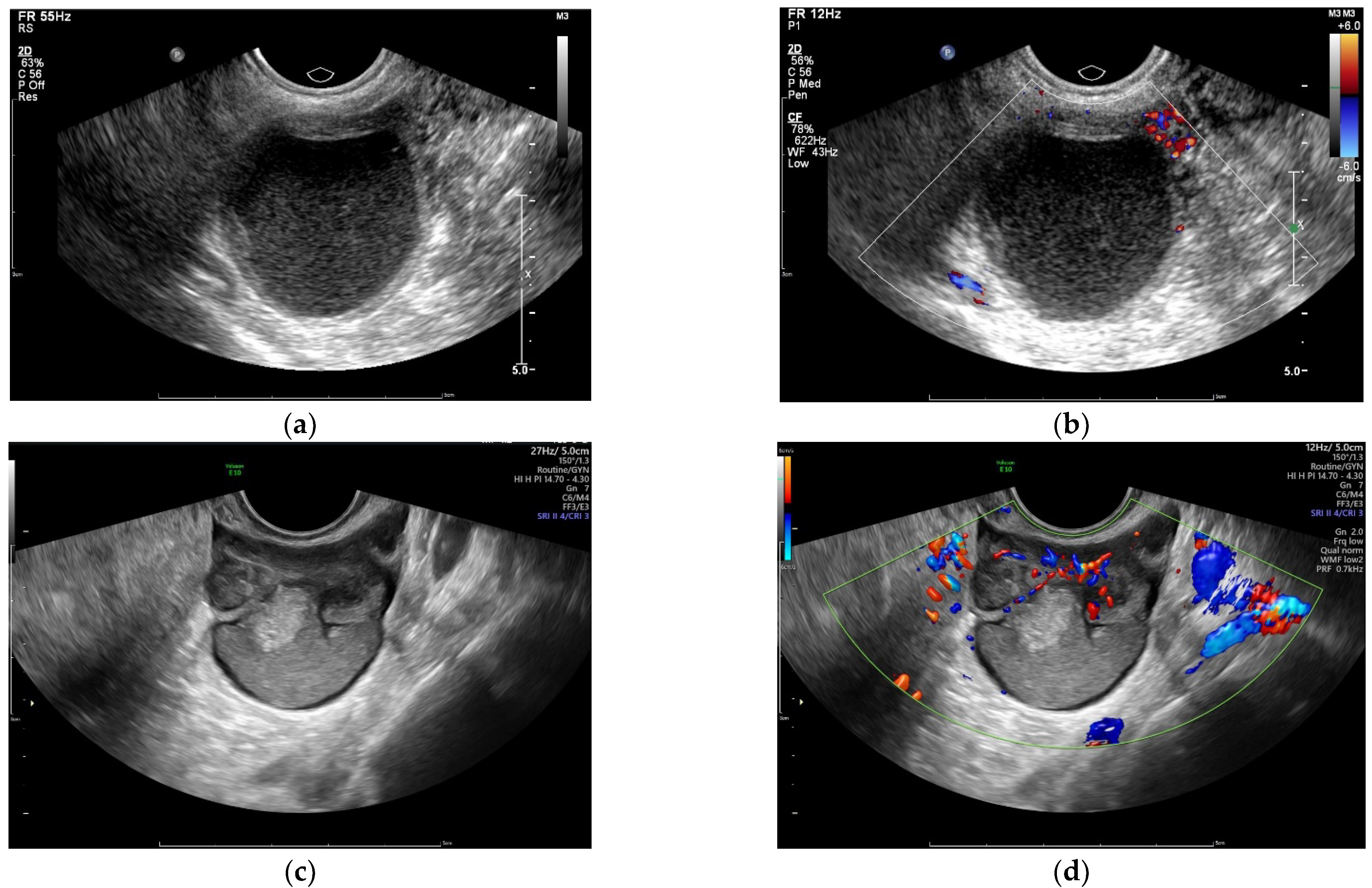Diagnostics 12 02348 g001