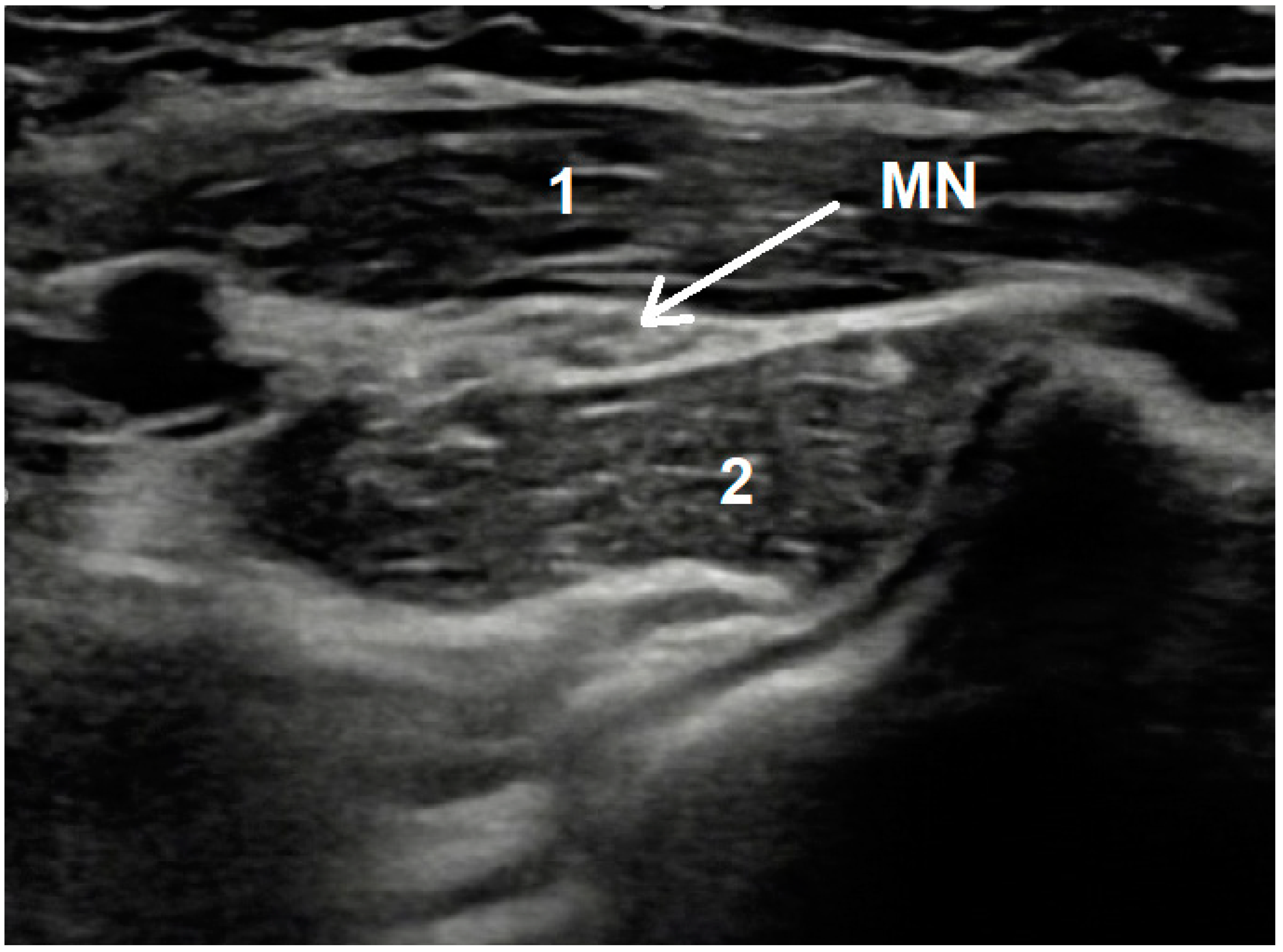 Diagnostics 12 02433 g002 Diagnostics 12 02433 g002