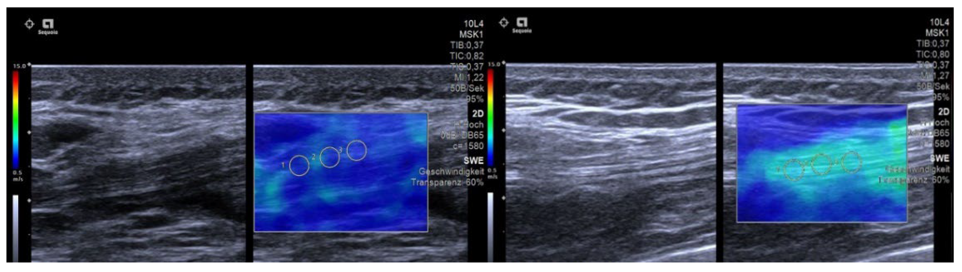 Diagnostics 12 02453 g004