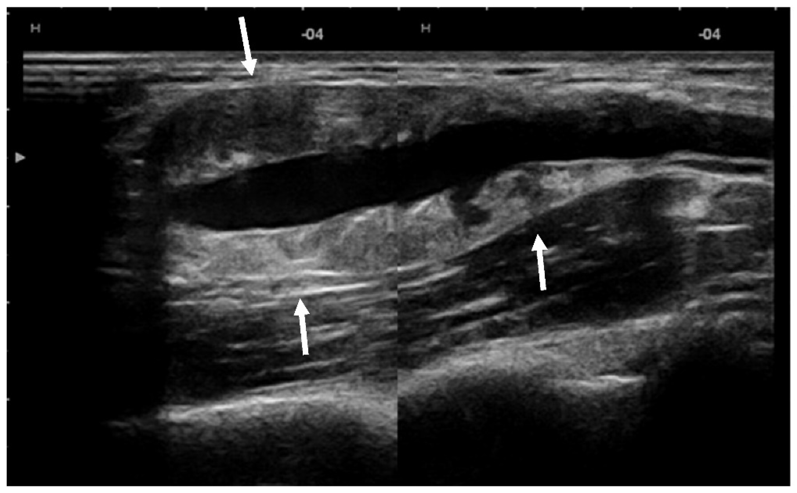 Diagnostics 12 02473 g002 Diagnostics 12 02473 g002