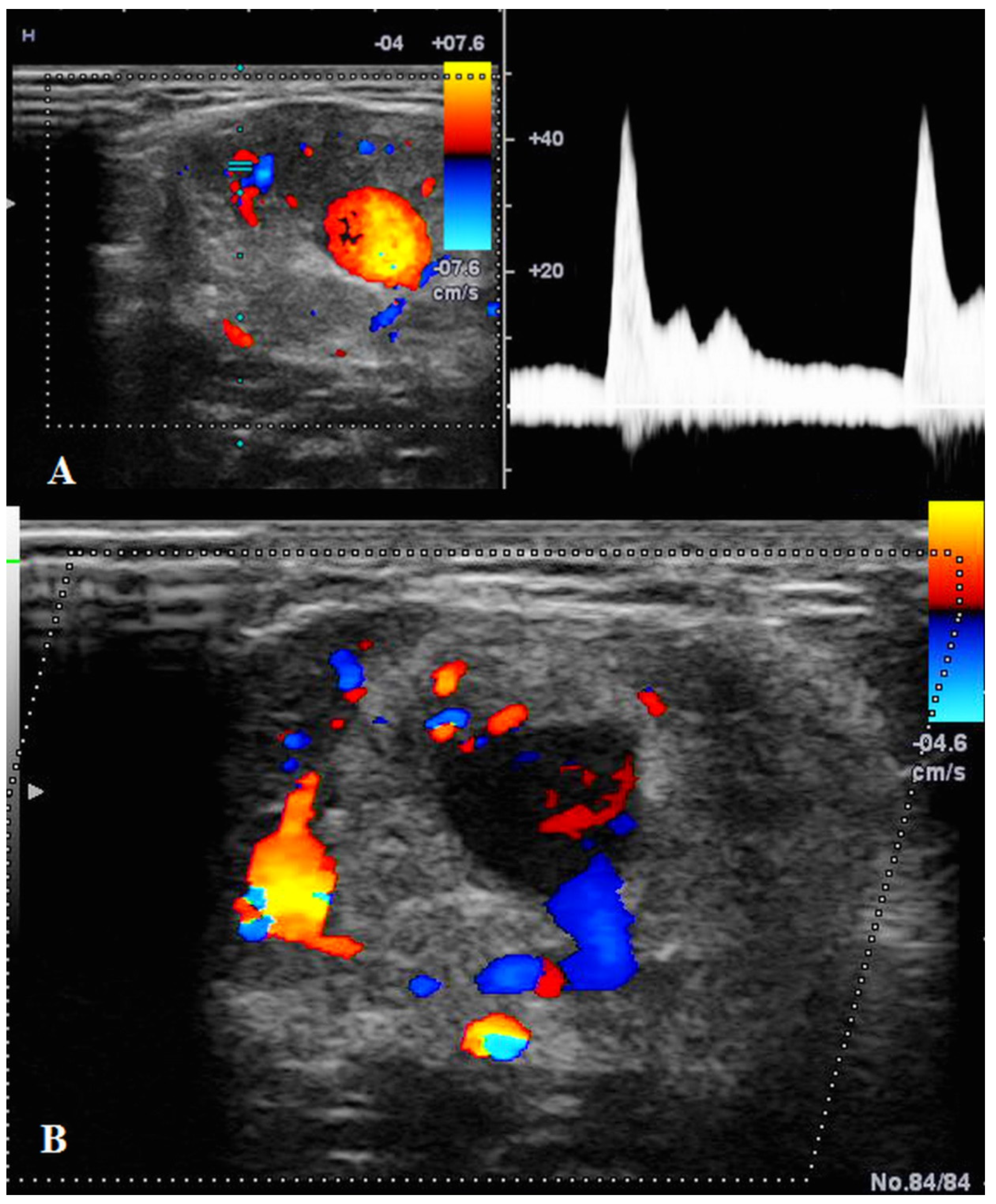 Diagnostics 12 02473 g003 Diagnostics 12 02473 g003